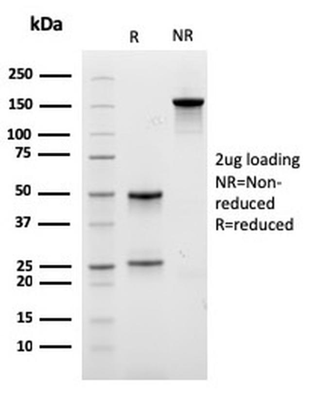 Lambda Light Chain Antibody in SDS-PAGE (SDS-PAGE)