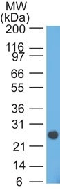 Lambda Light Chain (B-Cell Marker) Antibody in Western Blot (WB)