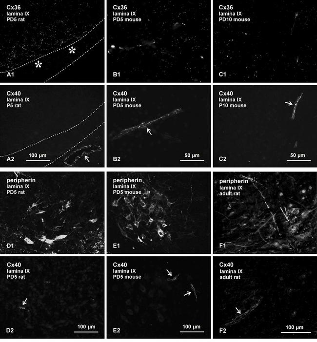 Connexin 40 Antibody in Immunohistochemistry (IHC)