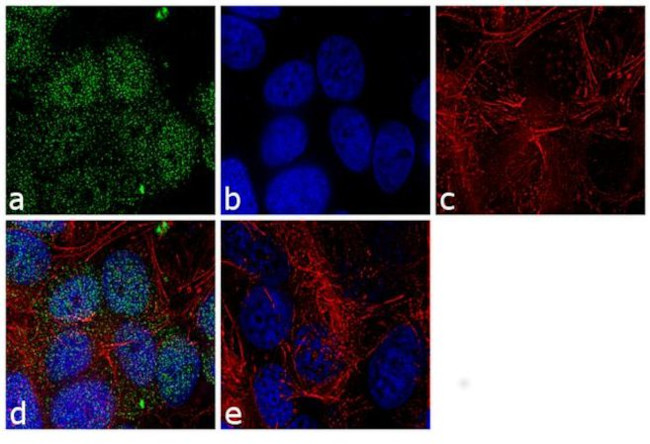 MGMT Antibody in Immunocytochemistry (ICC/IF)