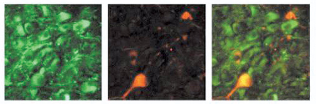 alpha Synuclein Antibody in Immunohistochemistry (IHC)