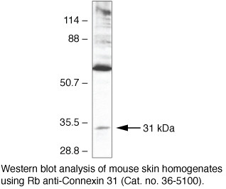 Connexin 31 Antibody in Western Blot (WB)