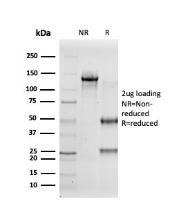 Inhibin, alpha (INHA) (Gonadal Cell Marker) Antibody in SDS-PAGE (SDS-PAGE)