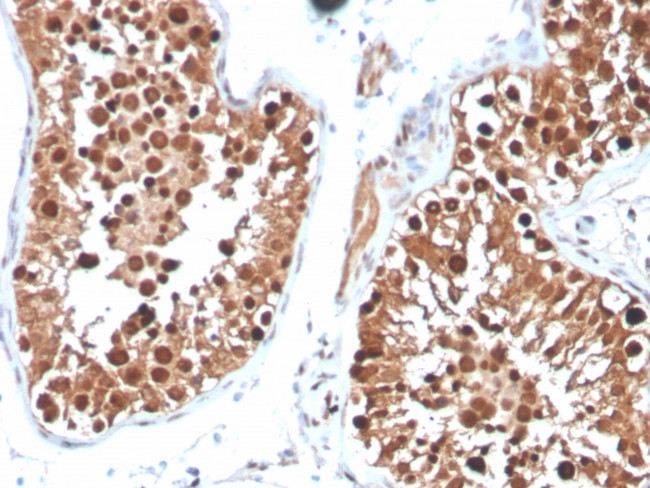 Inhibin, alpha (INHA) (Gonadal Cell Marker) Antibody in Immunohistochemistry (Paraffin) (IHC (P))