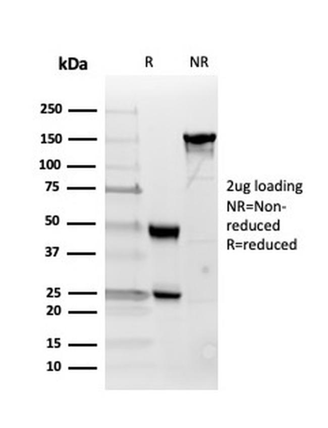 Inhibin, alpha (INHA) Antibody in SDS-PAGE (SDS-PAGE)