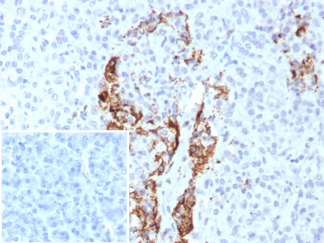 Insulin/IRDN (beta-Cell and Insulinoma Marker) Antibody in Immunohistochemistry (Paraffin) (IHC (P))