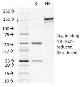 Insulin/IRDN (beta-Cell and Insulinoma Marker) Antibody in SDS-PAGE (SDS-PAGE)