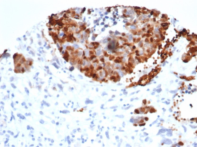 INSM1 (Pan-Neuroendocrine Marker) Antibody in Immunohistochemistry (Paraffin) (IHC (P))