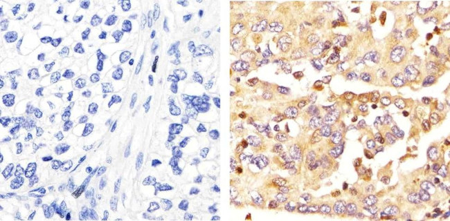 IRAK4 Antibody in Immunohistochemistry (Paraffin) (IHC (P))