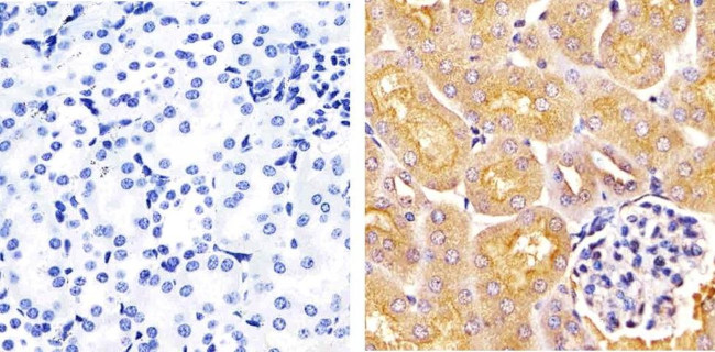 IRAK4 Antibody in Immunohistochemistry (Paraffin) (IHC (P))