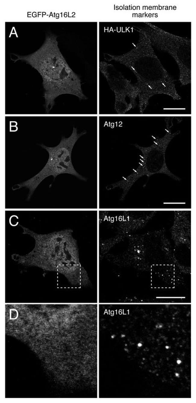 ATG12 Antibody in Immunocytochemistry (ICC/IF)