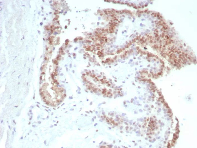 Androgen Receptor (Marker of Androgen Dependence) Antibody in Immunohistochemistry (Paraffin) (IHC (P))