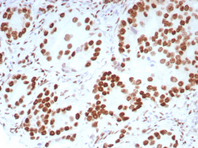 Androgen Receptor (Marker of Androgen Dependence) Antibody in Immunohistochemistry (Paraffin) (IHC (P))