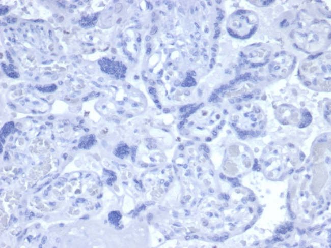 Androgen Receptor Antibody in Immunohistochemistry (Paraffin) (IHC (P))