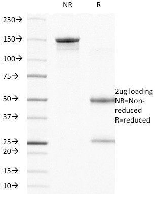 CD104 (Integrin Beta-4) (Squamous Cell Carcinoma Antigen) Antibody in SDS-PAGE (SDS-PAGE)