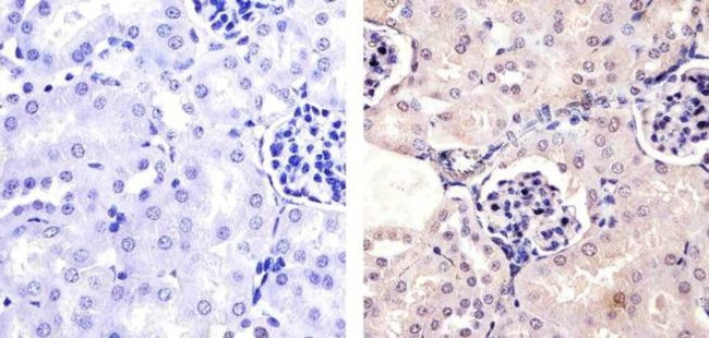 Phospho-PAX2 (Ser393) Antibody in Immunohistochemistry (Paraffin) (IHC (P))