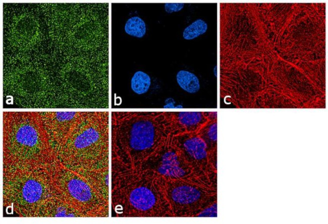 MUC5B Antibody in Immunocytochemistry (ICC/IF)