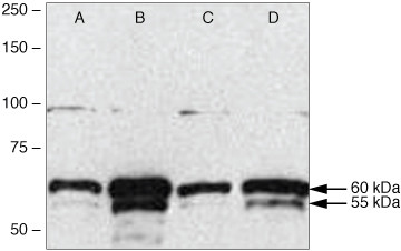 TRAF6 Antibody in Western Blot (WB)