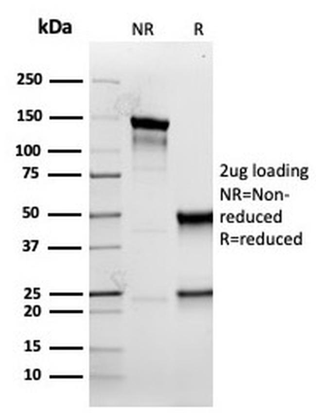 Cytokeratin 5 (KRT5) Antibody in SDS-PAGE (SDS-PAGE)
