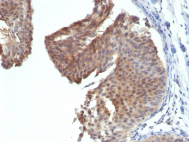 Cytokeratin 6 (KRT6) (Basal Cell Marker) Antibody in Immunohistochemistry (Paraffin) (IHC (P))