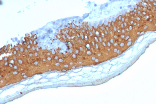 Cytokeratin 10 (KRT10) (Suprabasal Epithelial Marker) Antibody in Immunohistochemistry (Paraffin) (IHC (P))