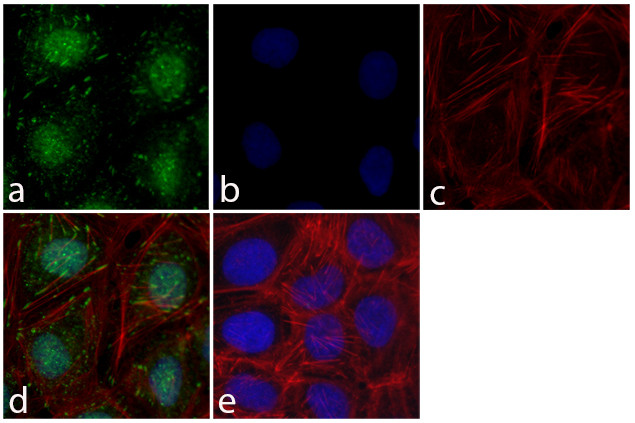 FAK Antibody in Immunocytochemistry (ICC/IF)