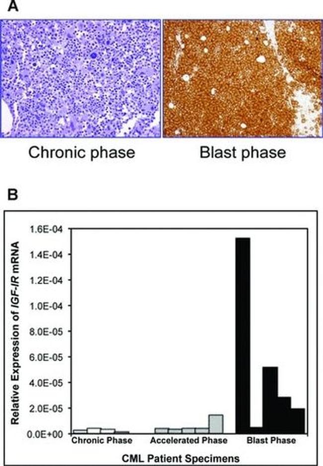 IGF1R beta Antibody in Immunohistochemistry (IHC)