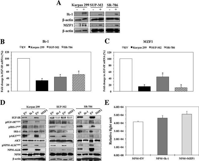 IGF1R beta Antibody in Western Blot (WB)