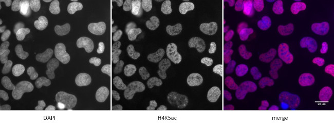 Histone H4K5ac Antibody in Immunocytochemistry (ICC/IF)