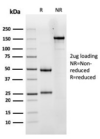 Luteinizing Hormone/Choriogonadotropin Receptor (LHCGR) Antibody in SDS-PAGE (SDS-PAGE)