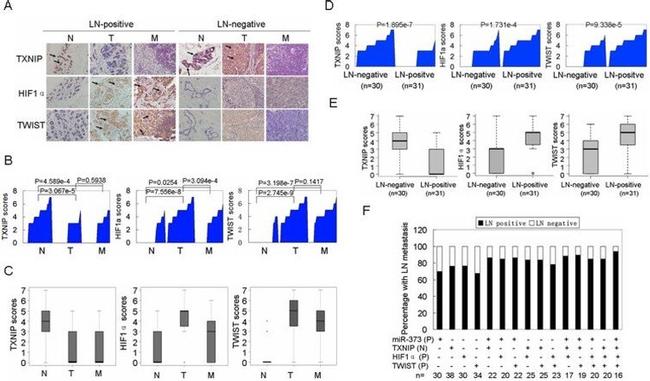 TXNIP Antibody in Immunohistochemistry (IHC)