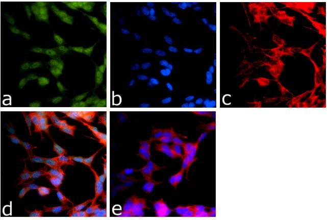 DISC1 Antibody in Immunocytochemistry (ICC/IF)