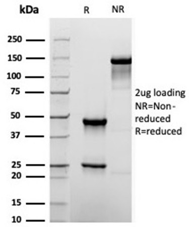 TACSTD2/TROP2 (Epithelial Marker) Antibody in SDS-PAGE (SDS-PAGE)