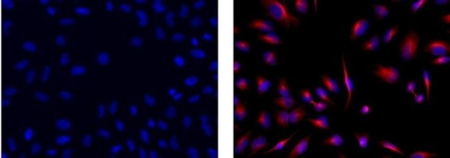 Mouse IgG1 Secondary Antibody in Immunocytochemistry (ICC/IF)