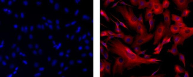 beta-3 Tubulin Antibody in Immunocytochemistry (ICC/IF)