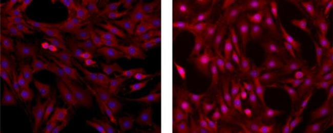 ERK1/2 Antibody in Immunocytochemistry (ICC/IF)