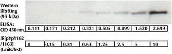 Human IR (Phospho) [pY1162/pY1163] ELISA Kit