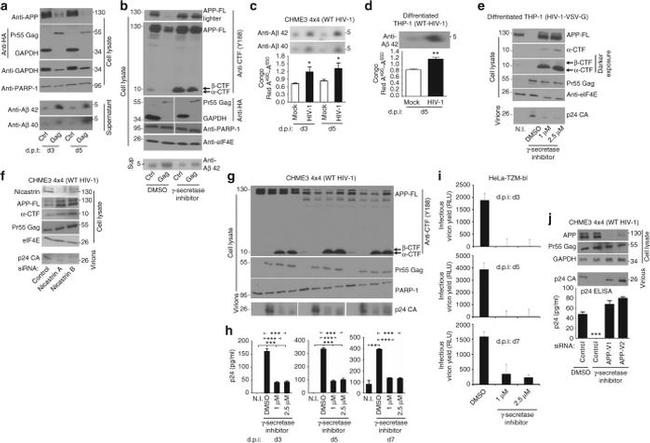 Amyloid Precursor Protein Antibody in Western Blot (WB)