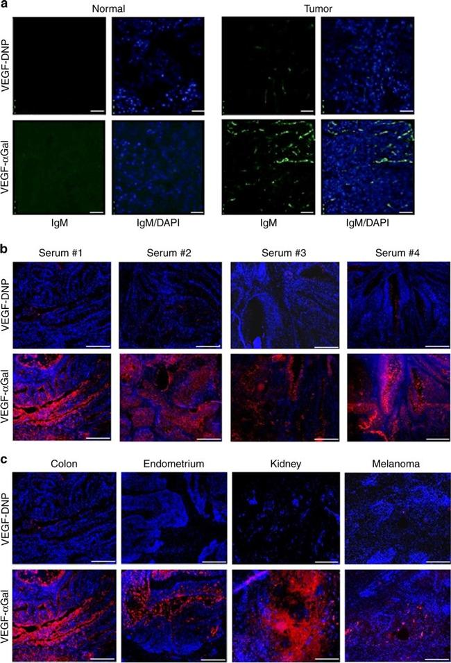 Dinitrophenyl-KLH Antibody in Immunohistochemistry (IHC)