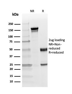 Phospho-Myelin Basic Protein (Marker of Oligodendrocytes and Myelin) (Thr98) Antibody in SDS-PAGE (SDS-PAGE)