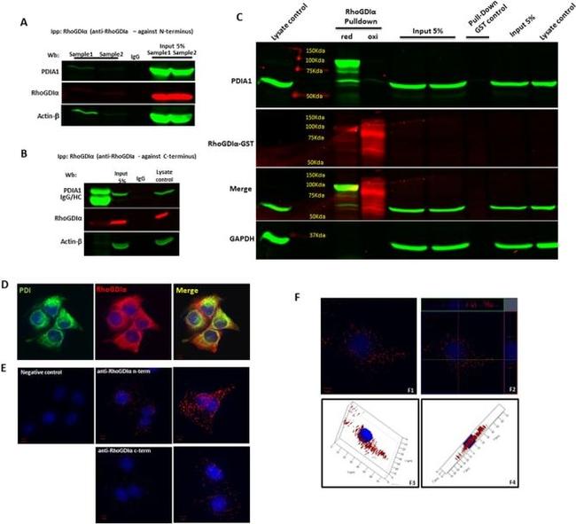 PDI Antibody in Immunocytochemistry (ICC/IF)