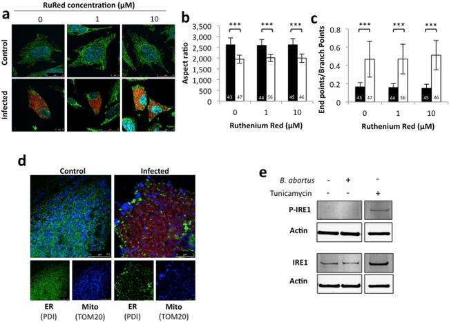 PDI Antibody in Immunocytochemistry (ICC/IF)