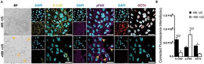 Phospho-FAK (Tyr397) Antibody in Immunocytochemistry (ICC/IF)