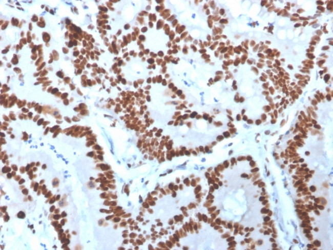 MCM6 Antibody in Immunohistochemistry (Paraffin) (IHC (P))