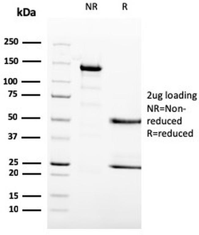 MCM6 Antibody in SDS-PAGE (SDS-PAGE)