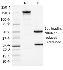 MCM7 (Proliferation Marker) Antibody in SDS-PAGE (SDS-PAGE)