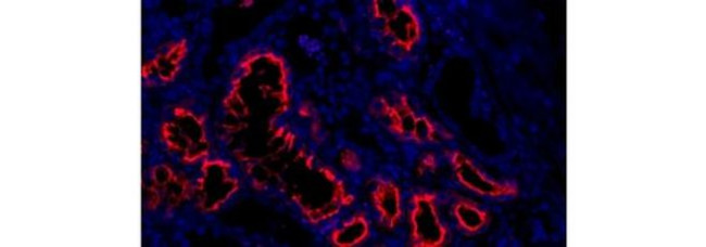 CD15 Antibody in Immunohistochemistry (Paraffin) (IHC (P))