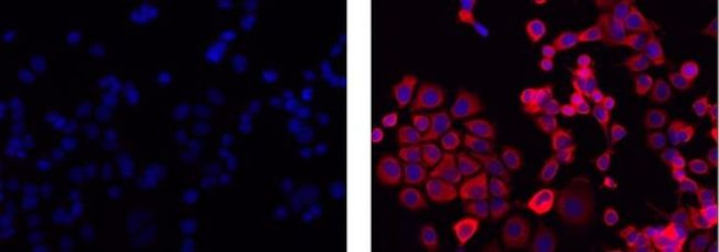 Cytokeratin 19 Antibody in Immunocytochemistry (ICC/IF)