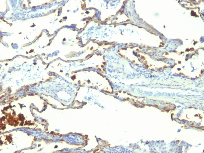 Milk Fat Globule (Breast Epithelial Marker) Antibody in Immunohistochemistry (Paraffin) (IHC (P))