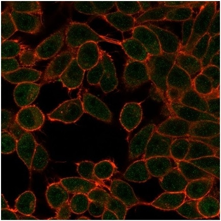 Microphthalmia Transcription Factor (MITF) Antibody in Immunocytochemistry (ICC/IF)